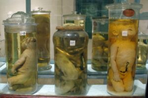 Museo Patologico Vienna